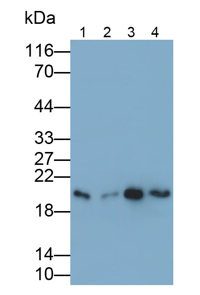 双特异性磷酸酶3(DUSP3)多克隆抗体