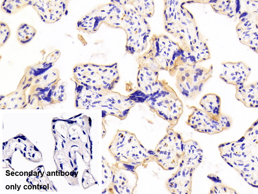 G蛋白偶聯(lián)雌激素受體1(GPER)多克隆抗體