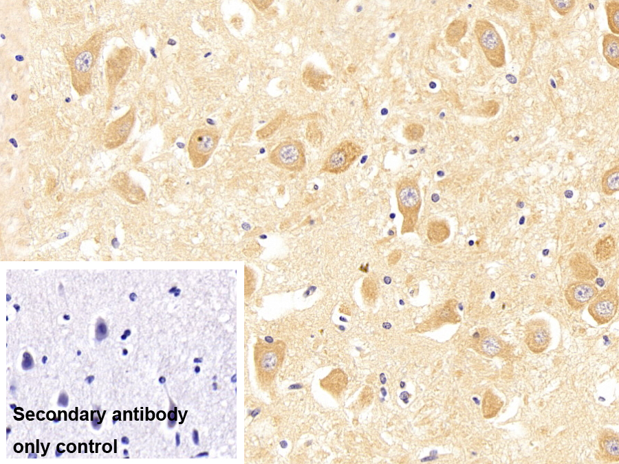 G蛋白偶聯(lián)雌激素受體1(GPER)多克隆抗體