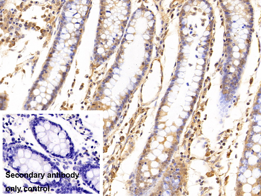蛋白酶體亞基β3(PSMb3)多克隆抗體