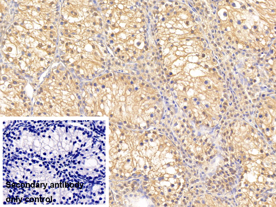 蛋白酶體亞基β3(PSMb3)多克隆抗體