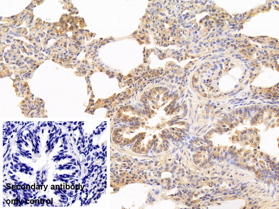 蛋白酶體亞基β3(PSMb3)多克隆抗體