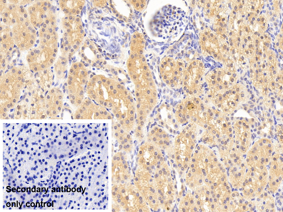 蛋白酶體亞基β3(PSMb3)多克隆抗體