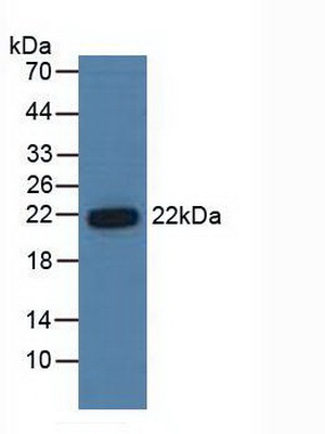 蛋白酶体亚基β6(PSMb6)多克隆抗体