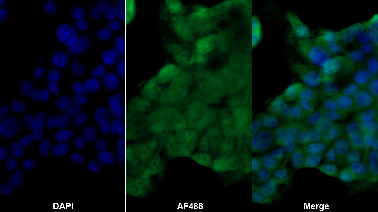 非ATP酶蛋白酶体26S亚基4(PSMD4)多克隆抗体