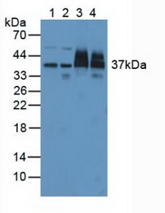 非ATP酶蛋白酶体26S亚基7(PSMD7)多克隆抗体
