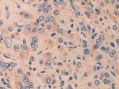 半胱氨酸丰富血管生成诱导因子61(CYR61)多克隆抗体