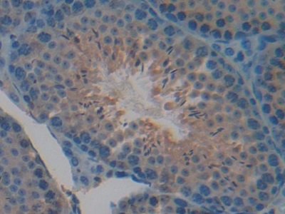 半胱氨酸丰富血管生成诱导因子61(CYR61)多克隆抗体