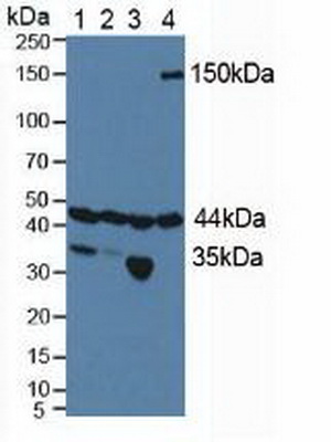 低氧诱导因子1α亚基抑制因子(HIF1aN)多克隆抗体
