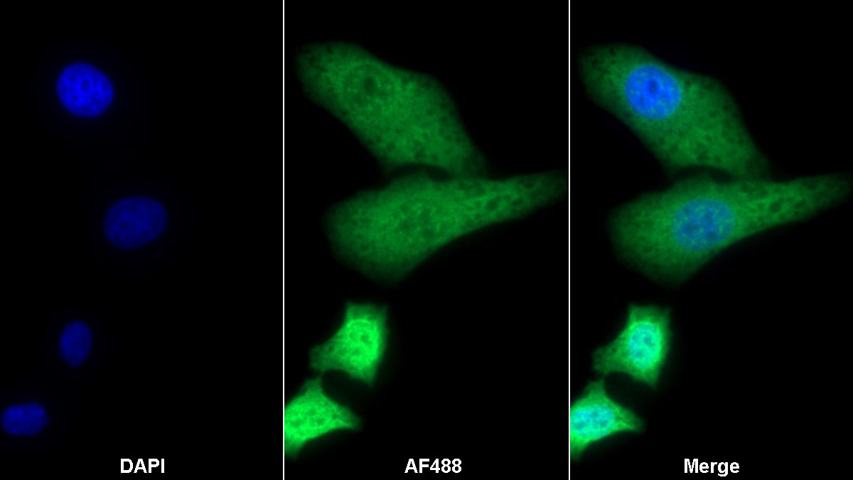 低氧诱导因子1α亚基抑制因子(HIF1aN)多克隆抗体