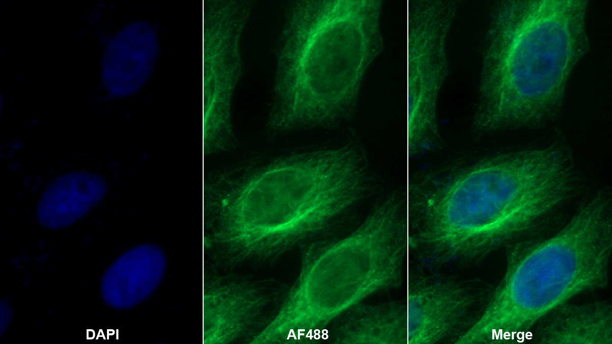 妊娠带蛋白(PZP)多克隆抗体