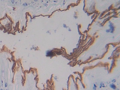 妊娠带蛋白(PZP)多克隆抗体