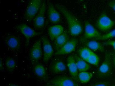 妊娠带蛋白(PZP)多克隆抗体