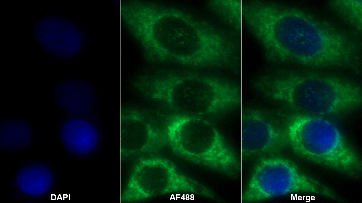 ATP酶抑制因子1(ATPIF1)多克隆抗体