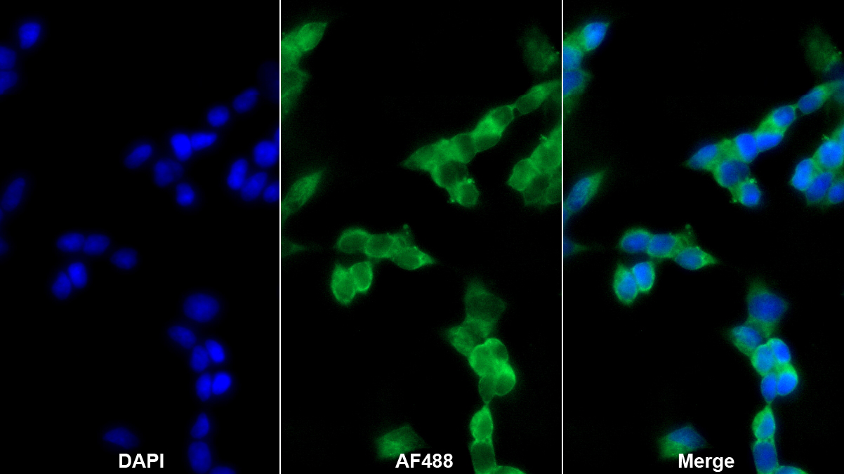 多巴脫羧酶(DDC)多克隆抗體