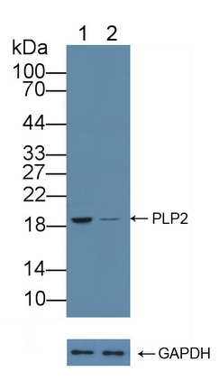 蛋白脂質(zhì)蛋白2(PLP2)多克隆抗體