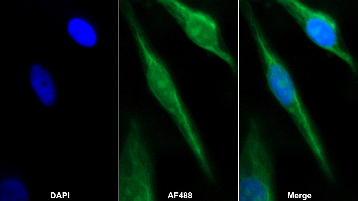 類固醇硫酸酯酶同工酶S(STS)多克隆抗體