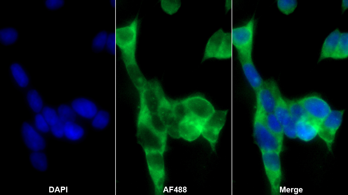 原肌球调节蛋白1(TMOD1)多克隆抗体