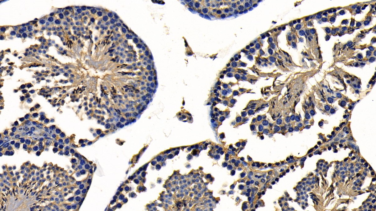 TNF受体关联因子6(TRAF6)多克隆抗体