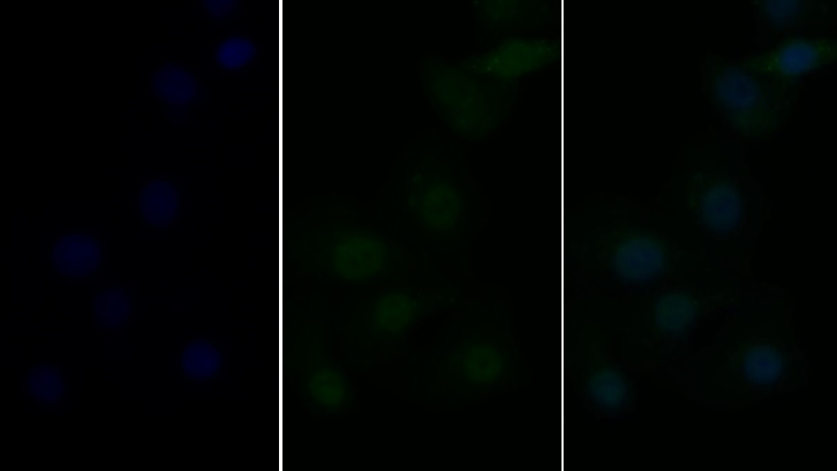 TNF受体关联因子6(TRAF6)多克隆抗体