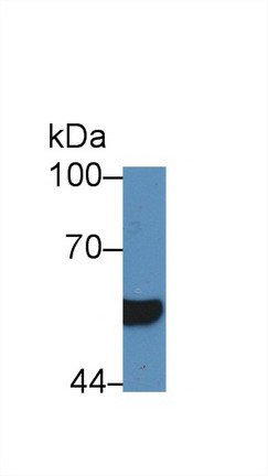 肝细胞核因子1β(HNF1b)多克隆抗体