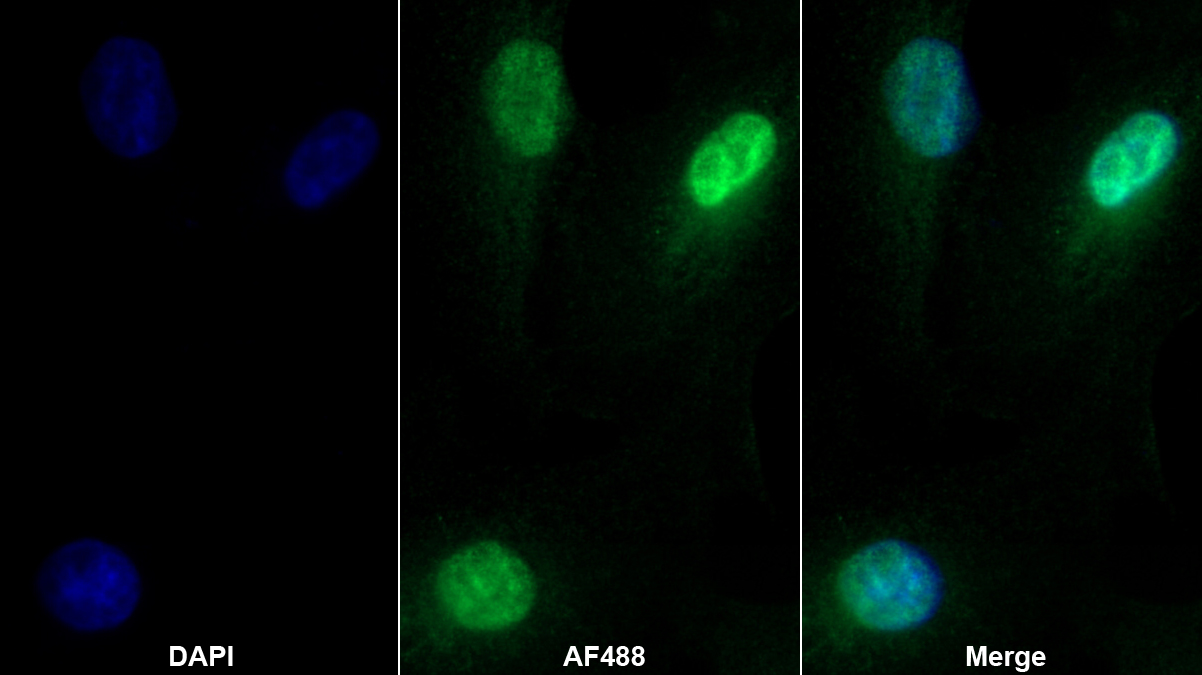 肝细胞核因子1β(HNF1b)多克隆抗体