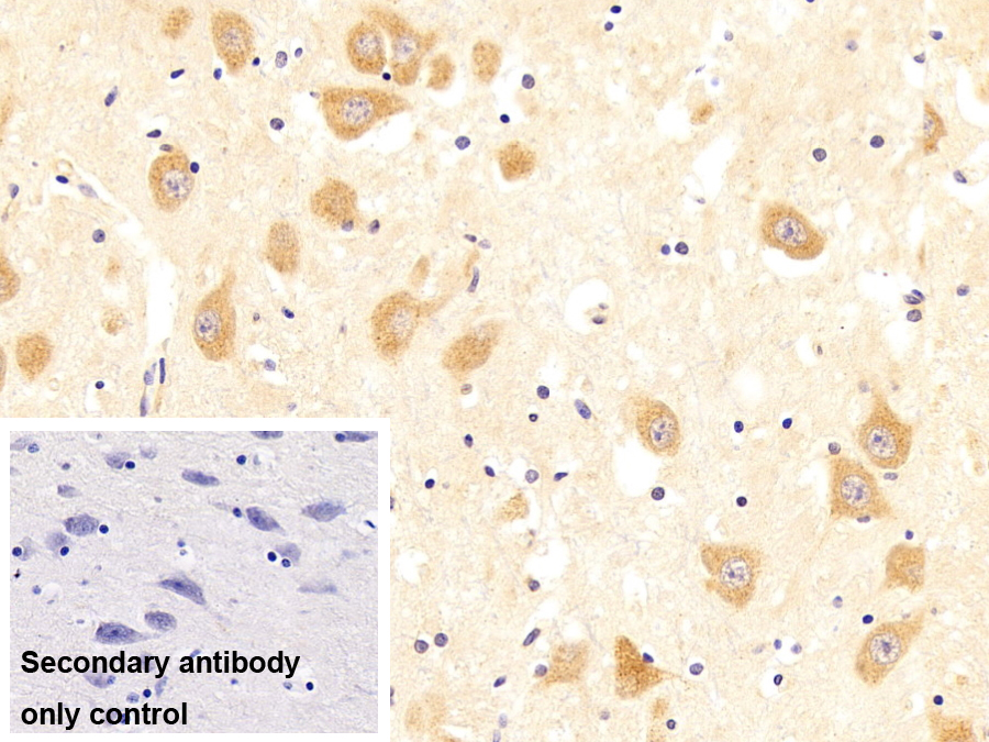 多核糖核苷酸核苷轉移酶1(PNPT1)多克隆抗體