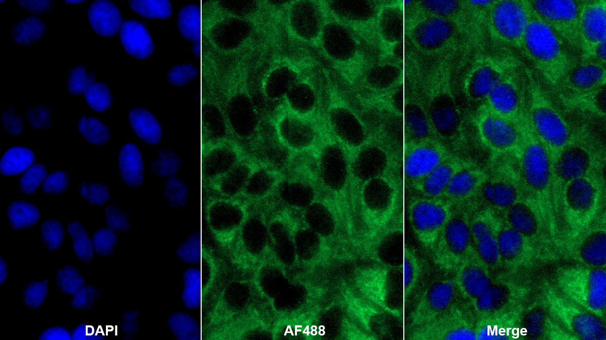 多核糖核苷酸核苷轉移酶1(PNPT1)多克隆抗體
