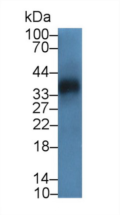 泛素羧基端酯酶L5(UCHL5)多克隆抗体