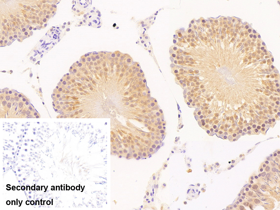 泛素羧基端酯酶L3(UCHL3)多克隆抗體