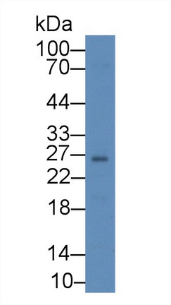 泛素羧基端酯酶L1(UCHL1)多克隆抗體