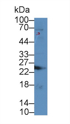 泛素羧基端酯酶L1(UCHL1)多克隆抗體