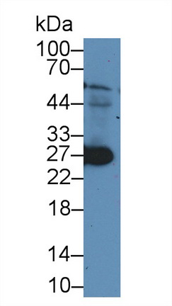 泛素羧基端酯酶L1(UCHL1)多克隆抗體