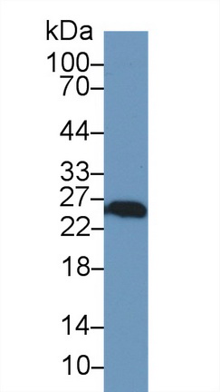 泛素羧基端酯酶L1(UCHL1)多克隆抗体