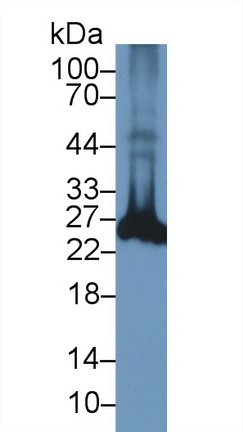 泛素羧基端酯酶L1(UCHL1)多克隆抗体