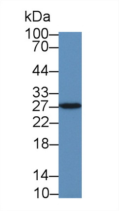 泛素羧基端酯酶L1(UCHL1)多克隆抗体