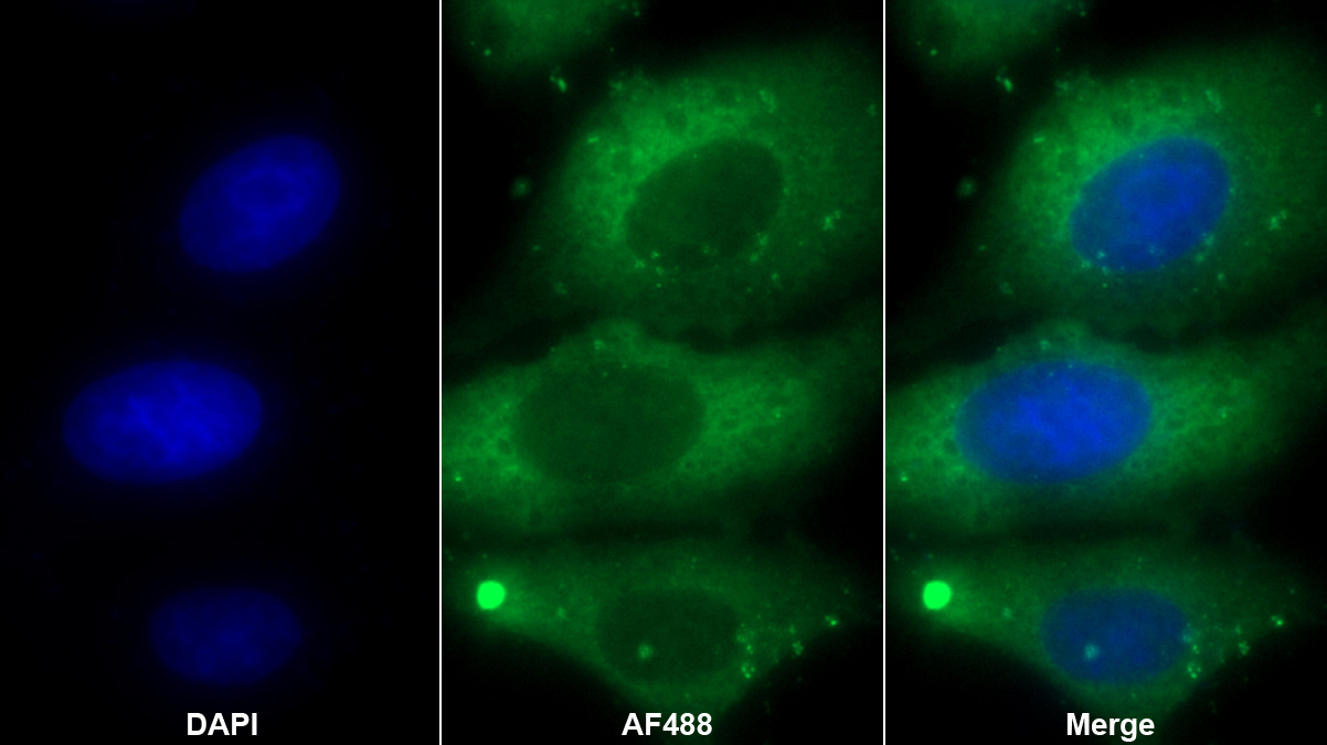 翻譯調(diào)節(jié)腫瘤蛋白1(TPT1)多克隆抗體
