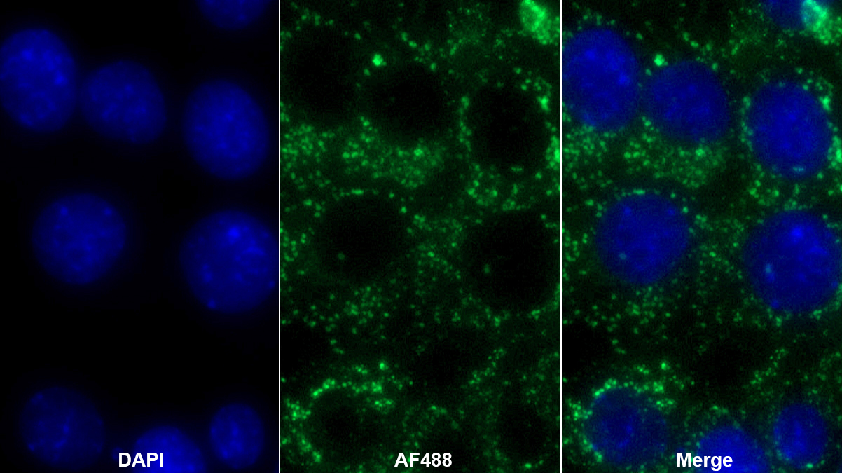 線粒體轉(zhuǎn)錄因子A(TFAM)多克隆抗體