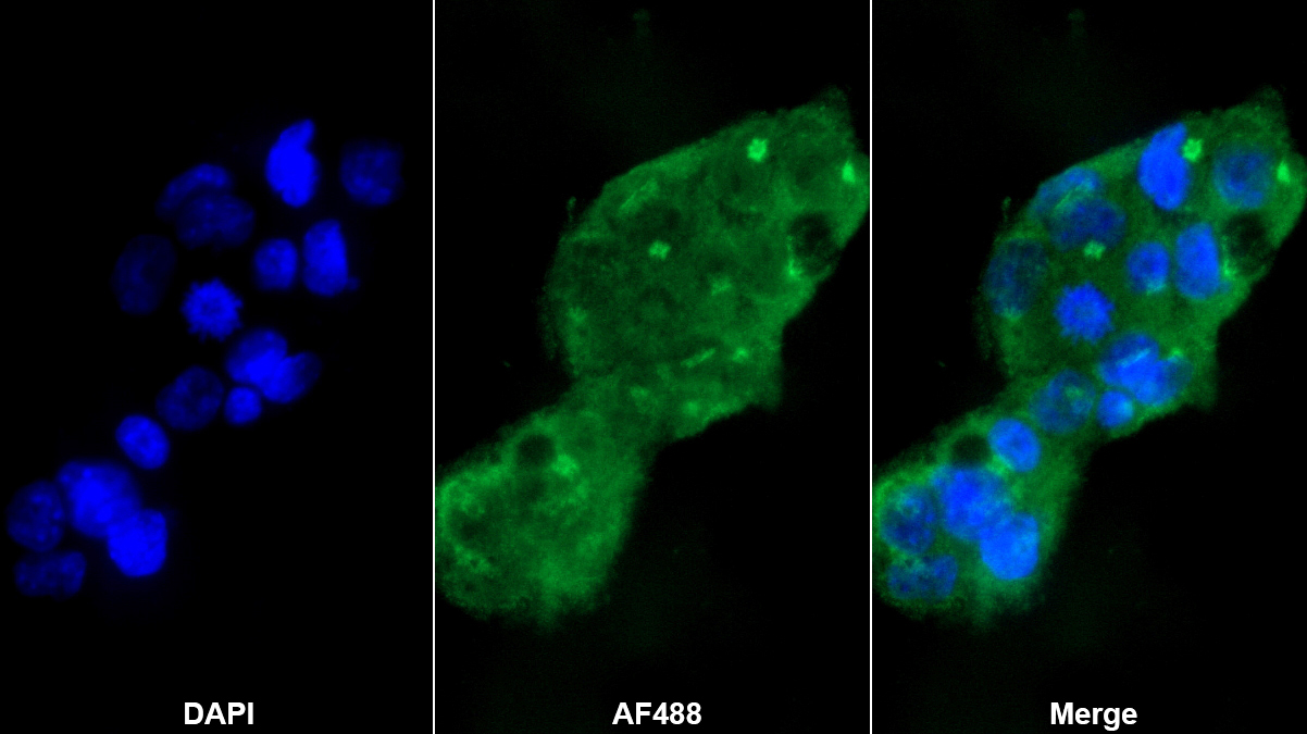 亞硫酸鹽氧化酶(SUOX)多克隆抗體