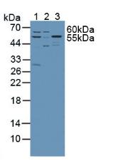 丝氨酸棕榈酰转移酶长链碱性亚基1(SPTLC1)多克隆抗体