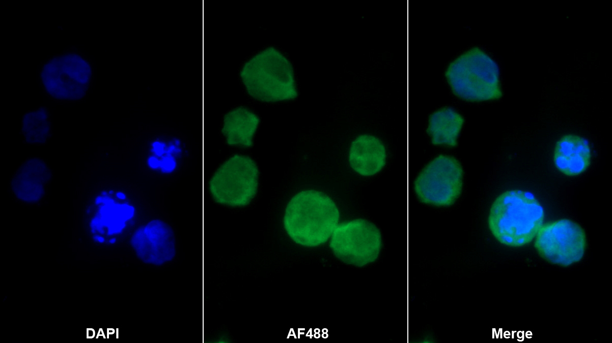 分泌型磷蛋白2(SPP2)多克隆抗体