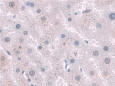 絲氨酸肽酶抑制因子Kunitz型2(SPINT2)多克隆抗體