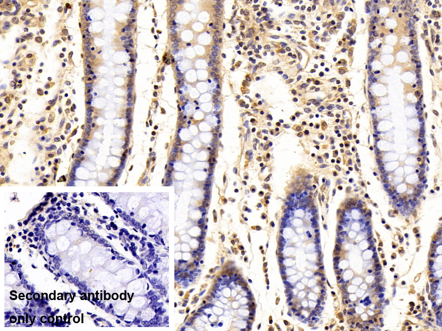 SET结合蛋白1(SETBP1)多克隆抗体