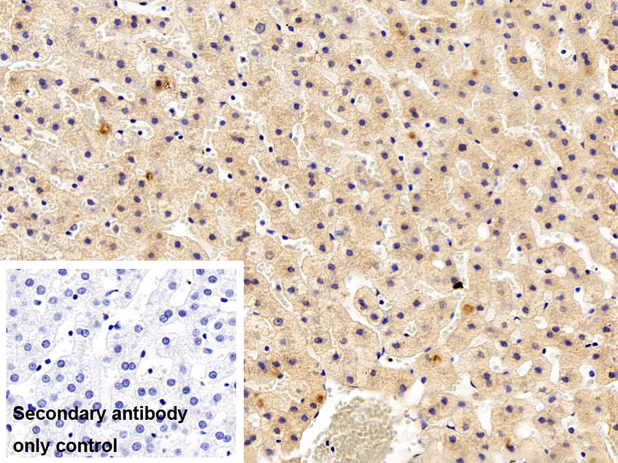 SET结合蛋白1(SETBP1)多克隆抗体