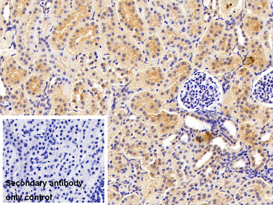 SET结合蛋白1(SETBP1)多克隆抗体