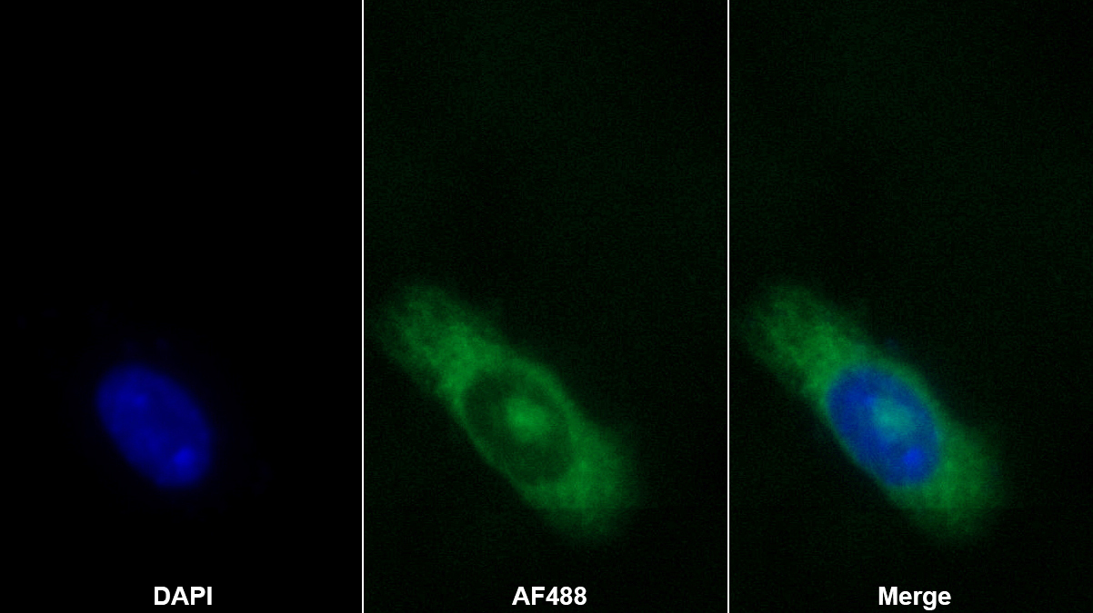 B類清道夫受體1(SCARB1)多克隆抗體
