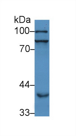 過(guò)氧化物酶體增殖物激活受體γ輔激活因子1α(PPARgC1a)多克隆抗體
