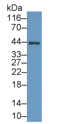 副腫瘤抗原MA2(PNMA2)多克隆抗體