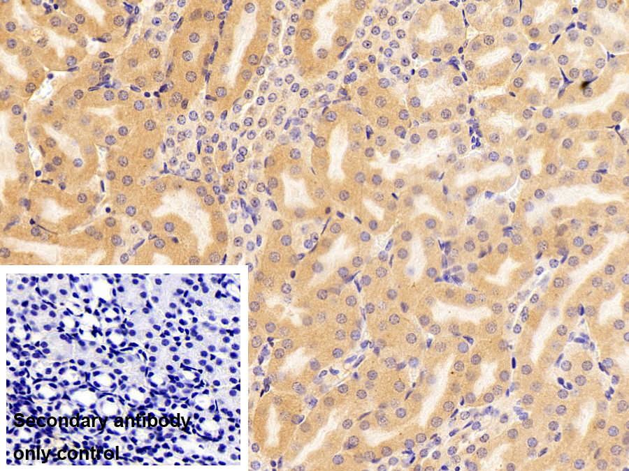 絲束蛋白1(PLS1)多克隆抗體