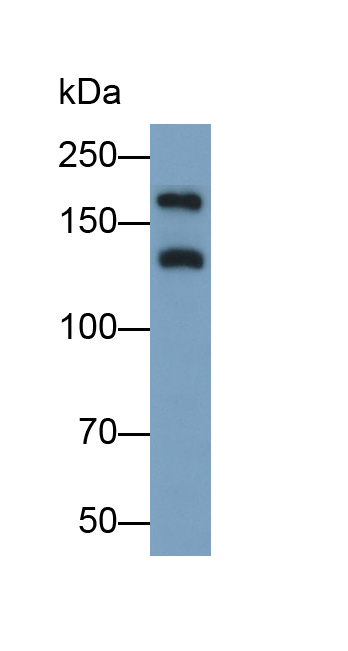 PHD指蛋白8(PHF8)多克隆抗体